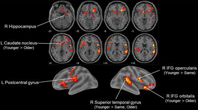 Feeling How Old I Am: Subjective Age Is Associated With Estimated Brain Age